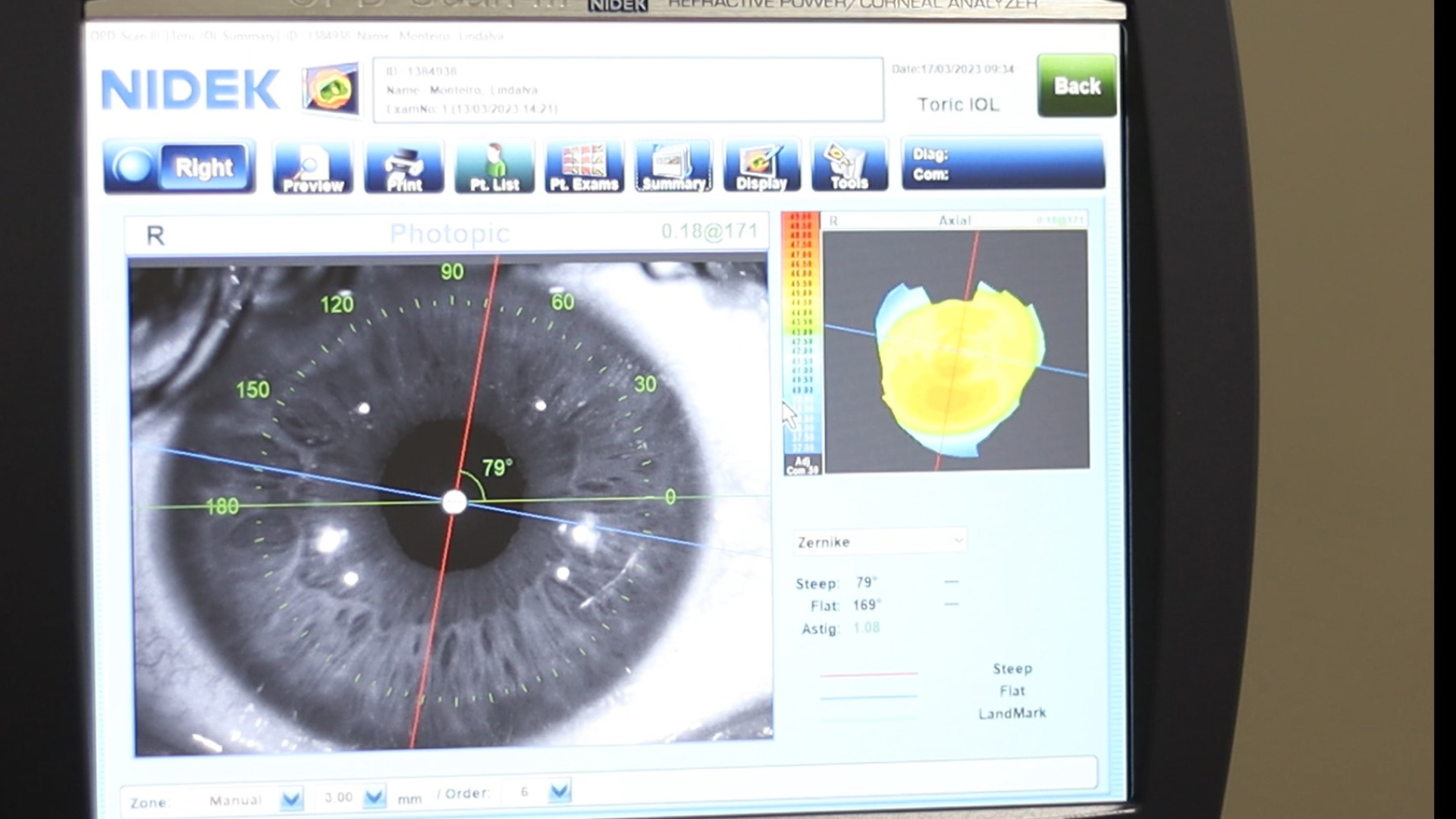 OPD SCAN