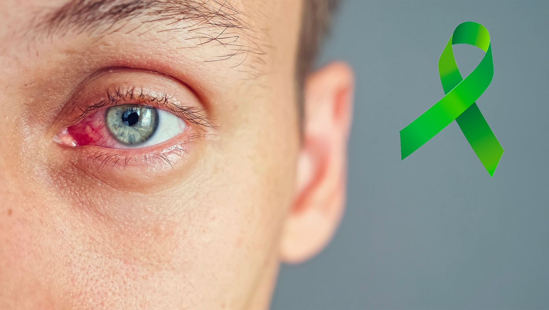 Glaucoma