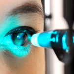 EXAME PARA DIAGNÓSTICO GLAUCOMA