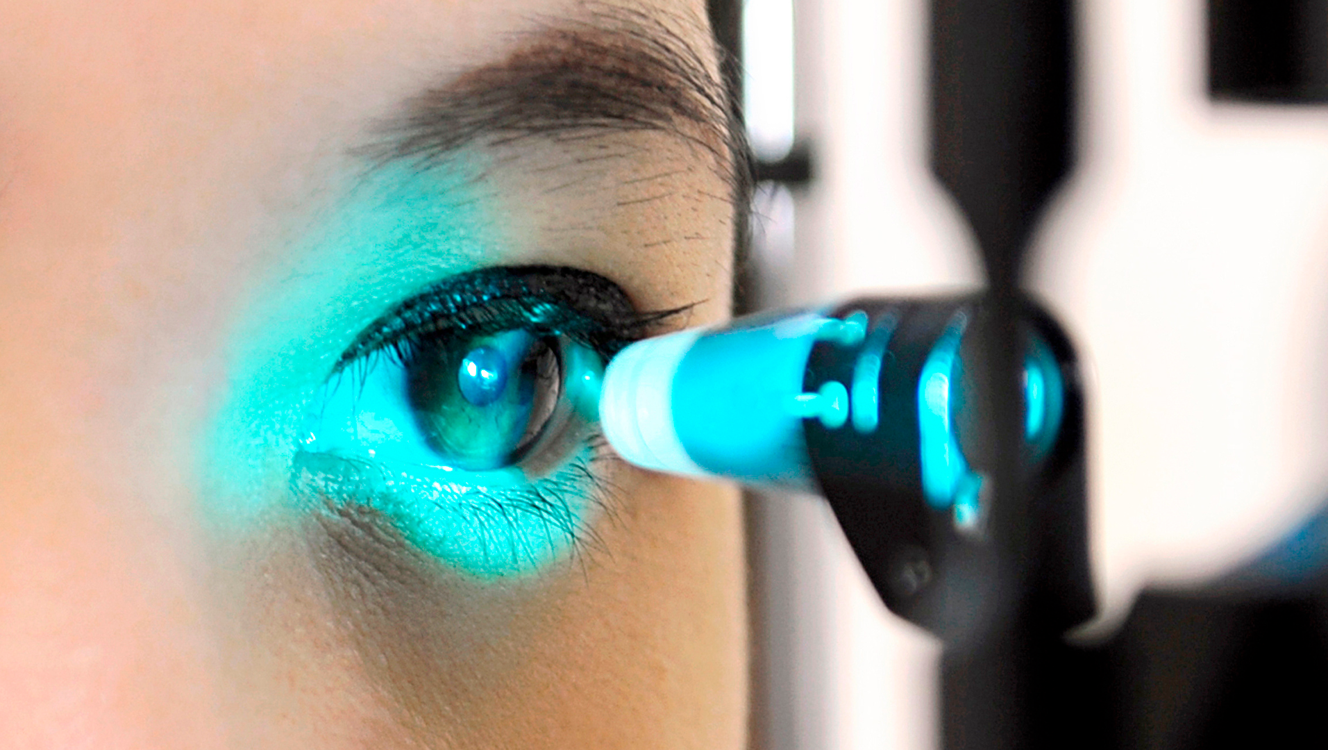 EXAME PARA DIAGNÓSTICO GLAUCOMA
